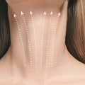 Discover the Power of Liquid Neck Lift Treatments